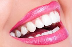 mouth with pink lipstick smiling with white teeth after teeth whitening Enid, OK